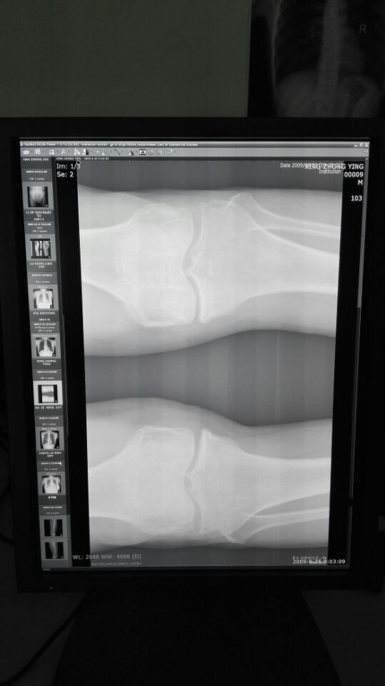 醫(yī)用顯示器