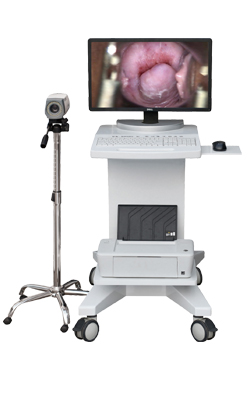 專業(yè)生產(chǎn)銷售陰道鏡