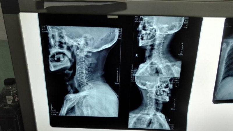 平板改裝（普通X光機(jī)升級(jí)DR）