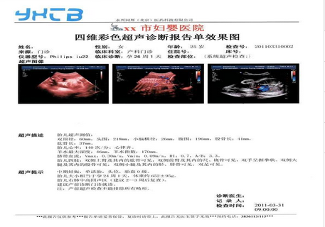 醫(yī)用干式膠片（噴墨 藍(lán)基 膠片）