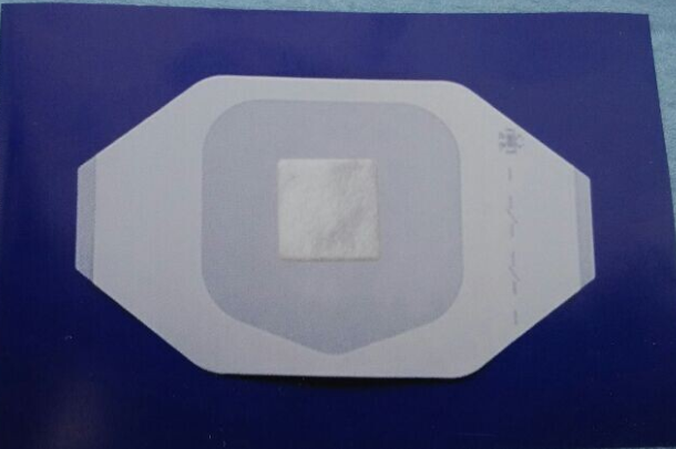 藻酸鹽傷口敷料