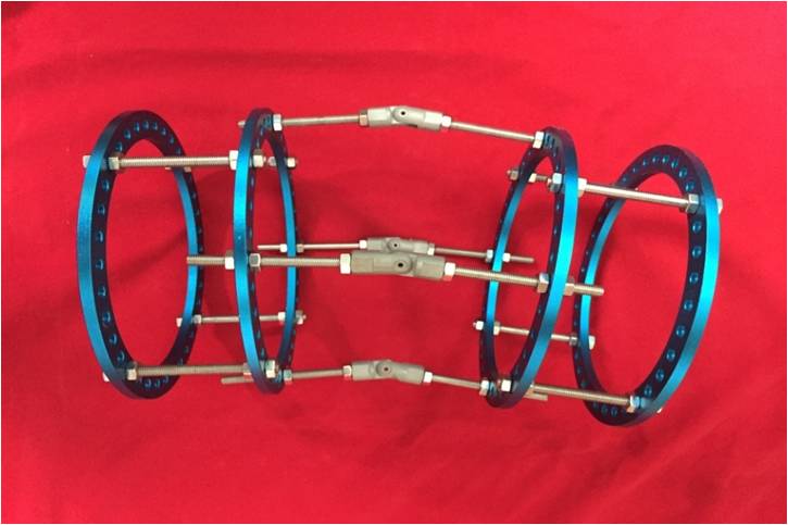 骨矯形（單平面）