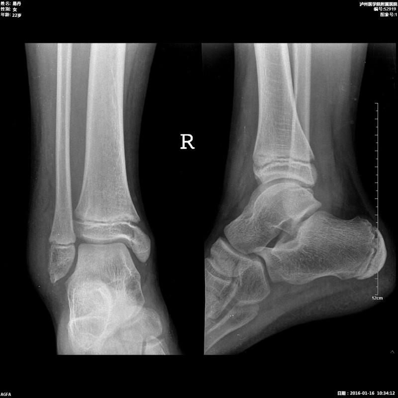 醫(yī)用膠片（B超、CT、DR）、自動(dòng)取片機(jī)