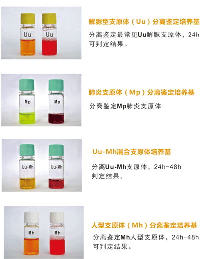 迪爾支原體（UU、Mh）分離培養(yǎng)藥敏試劑盒