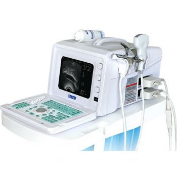 全數(shù)字超聲婦產(chǎn)科手術(shù)監(jiān)視儀