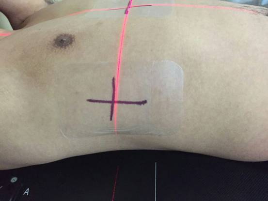 透氣膠貼系列產(chǎn)品招商