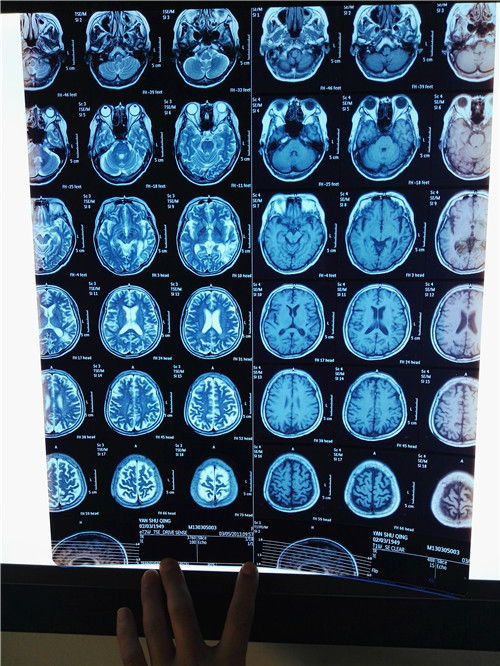 IMG_20160415_093432_BURST001_COVER