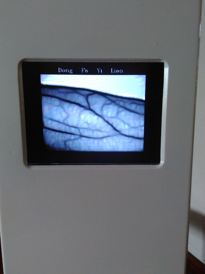 東發(fā)醫(yī)療廠家招商 靜脈顯像儀血管顯像儀 靜脈穿刺必備