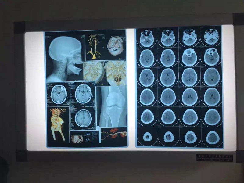 醫用放射科膠片
