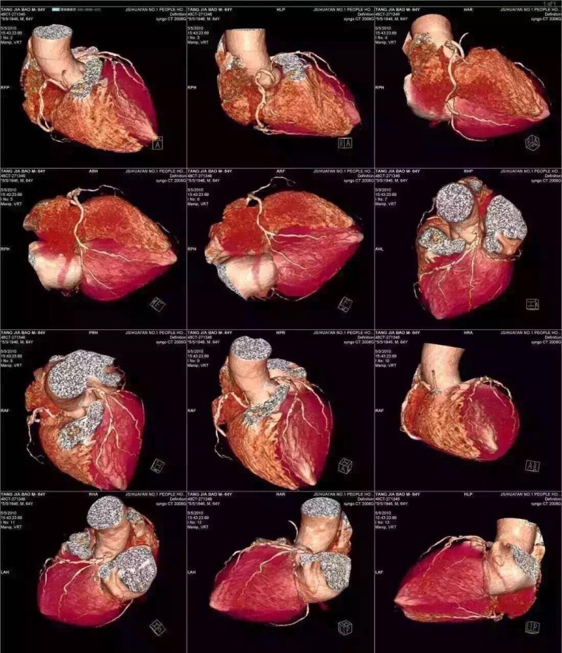醫用放射科膠片