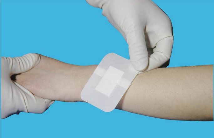 怡敷康無菌敷料 怡敷康無菌敷料