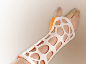 骨科新技術(shù)——3D打印手術(shù)夾板、支具