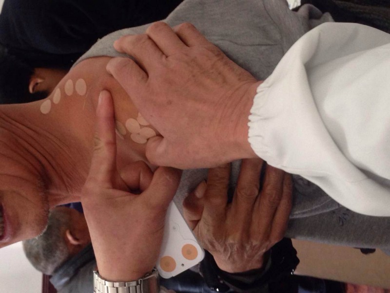 “卓脈”一次性使用無(wú)菌撳針（單/雙層固定）