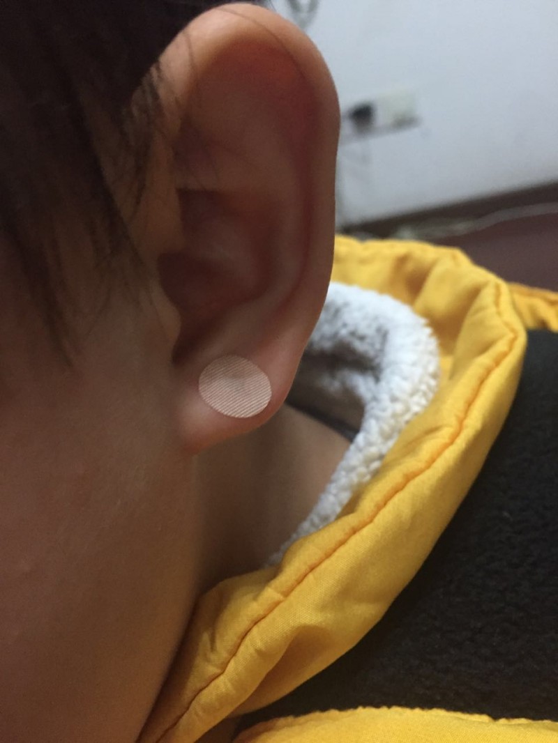 “卓脈“一次性使用無菌撳針（單層固定.綠盒）