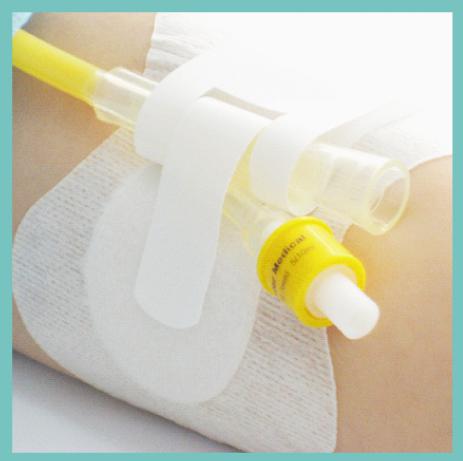 引流管固定換藥敷料（康泰定）