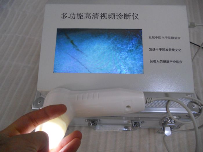 氣血檢測儀一體機