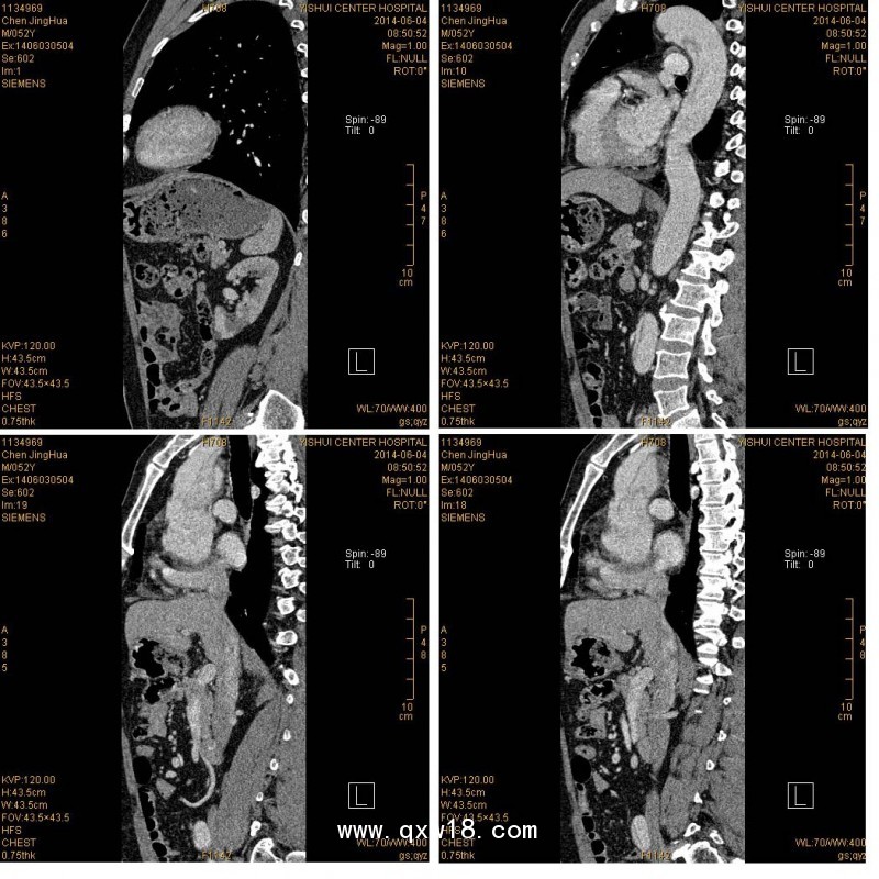 醫(yī)用膠片：藍基、瓷白、彩色影像膠片，影樓影像膠片