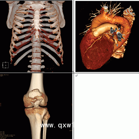 醫(yī)用膠片：藍基、瓷白、彩色影像膠片，影樓影像膠片
