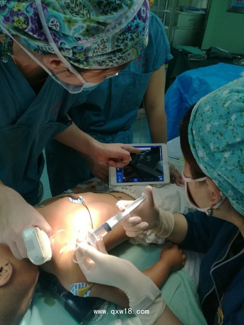 無線探頭式B超   全數(shù)字超聲顯像診斷儀