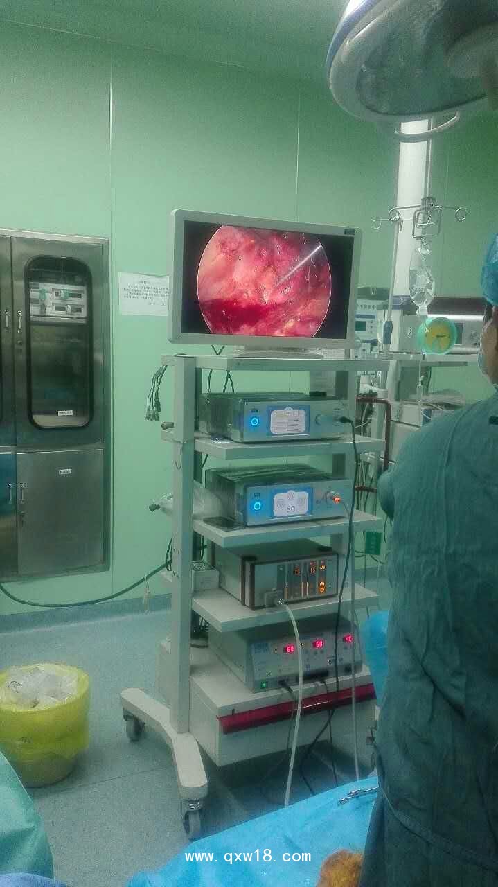 德國MGB高清腹腔鏡，高清膀胱鏡，高清輸尿管腎鏡，鼻竇鏡