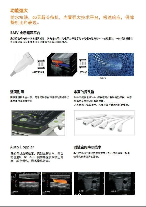 B超，監(jiān)護(hù)儀，心電圖，血壓計(jì)