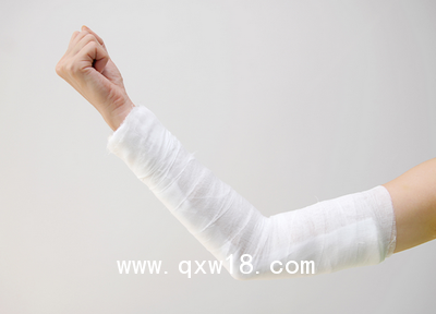 進(jìn)口醫(yī)用高分子卷夾板 骨科夾板ALPHA醫(yī)用高分子卷夾板