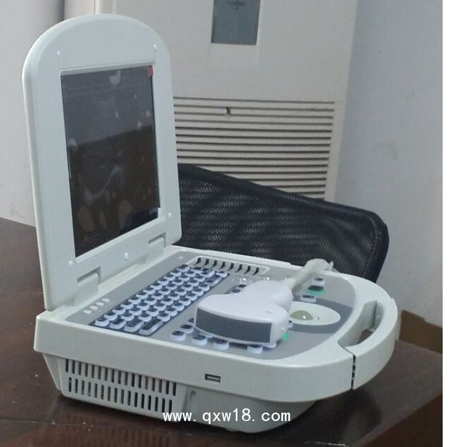 便攜式黑白B超 全數(shù)字超聲診斷系統(tǒng)手提式B超3W-2000
