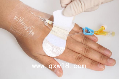 醫(yī)用導(dǎo)管夾 導(dǎo)管固定帖（置留針固定） A型中