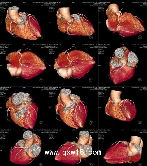 柯銳達(dá)醫(yī)用膠片自助區(qū)片機(jī)