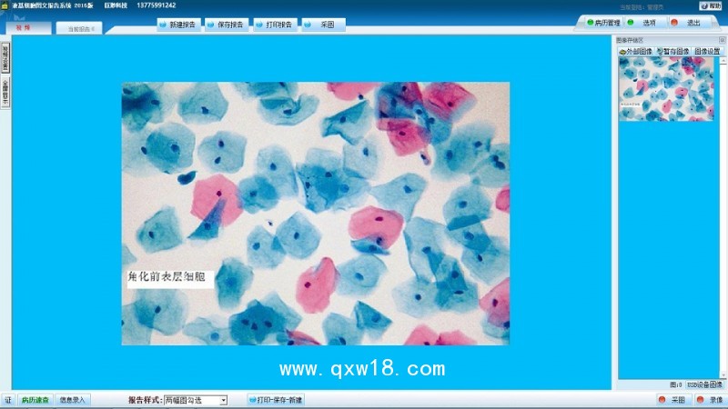 液基薄層細(xì)胞學(xué)檢測系統(tǒng) TBS TCT液基圖文報告系統(tǒng)軟件