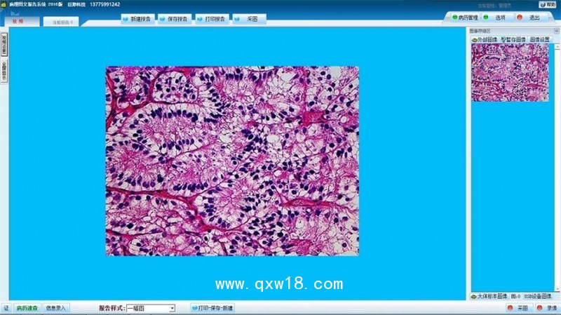 病理圖文分析系統(tǒng) 組織 細(xì)胞學(xué) 圖文報告影像工作站軟件