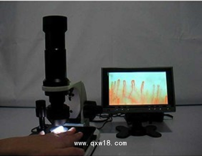 微循環(huán)檢測(cè)儀