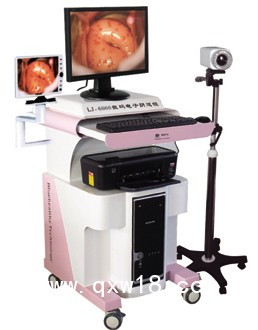 陰道鏡，高清陰道鏡，電子陰道鏡