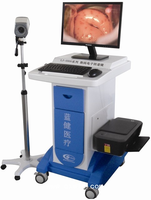 陰道鏡，高清陰道鏡，電子陰道鏡