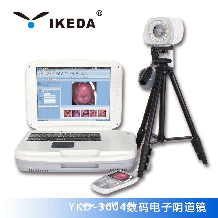 供應(yīng)紅外乳腺檢查儀|內(nèi)窺鏡攝像機|數(shù)碼電子陰道鏡