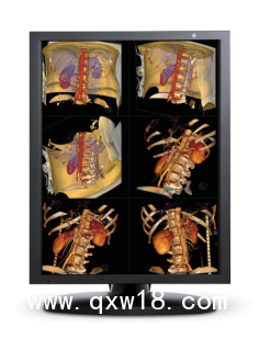 醫(yī)用顯示器｜放射顯示器｜監(jiān)視器