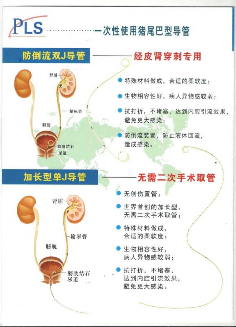 豬尾巴（雙J單J）導(dǎo)管