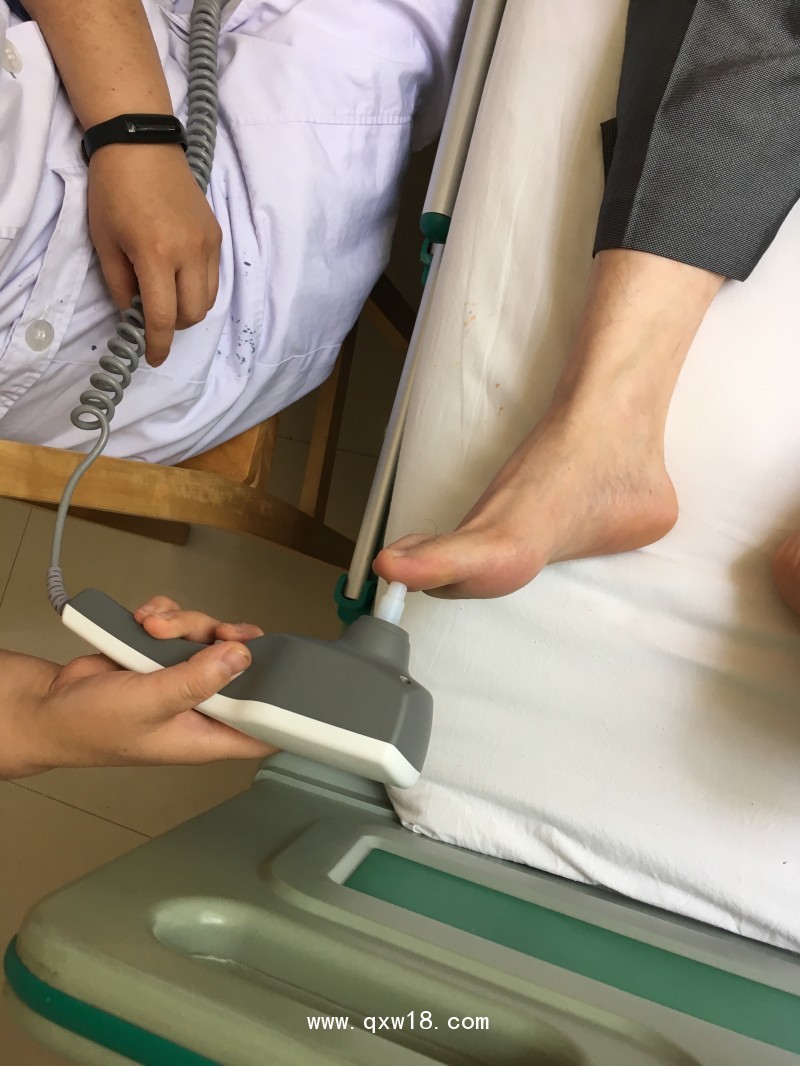 周圍神經(jīng)檢測儀