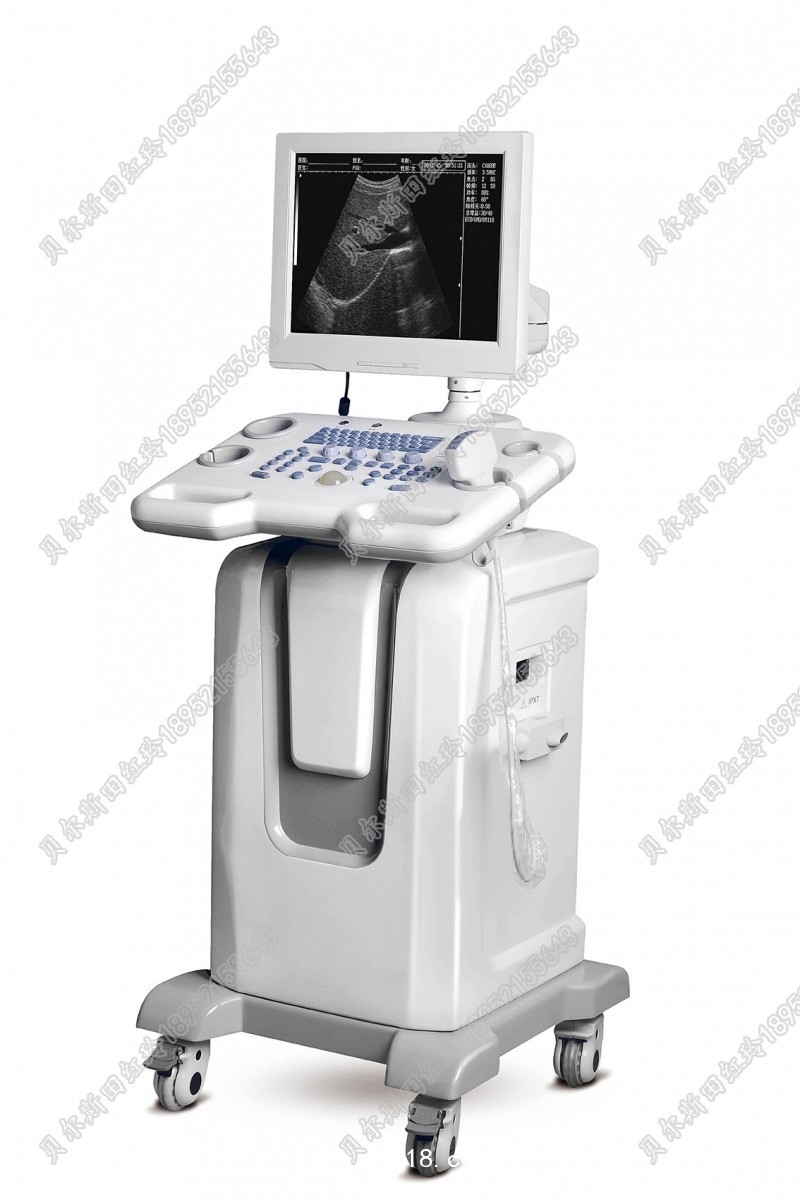 全數(shù)字超聲診斷系統(tǒng)