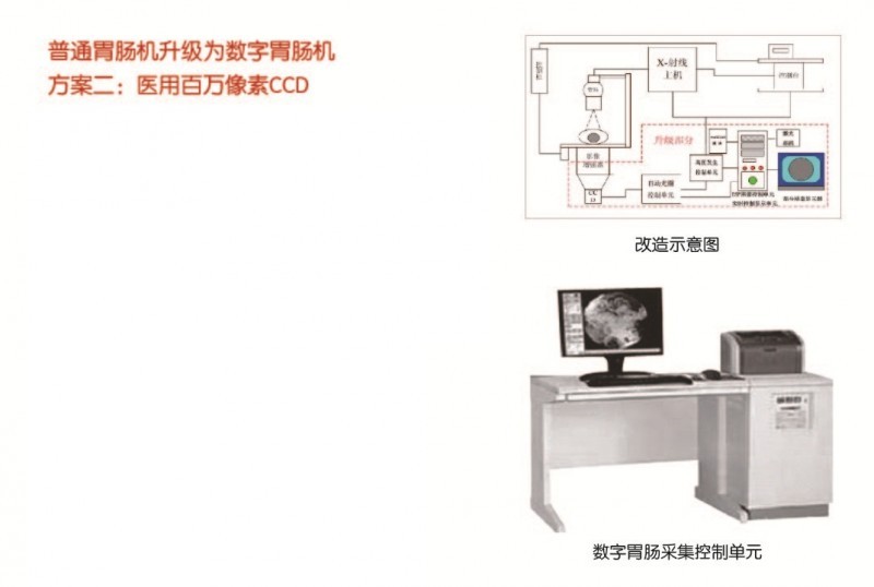 普通胃腸機升級為數字胃腸機