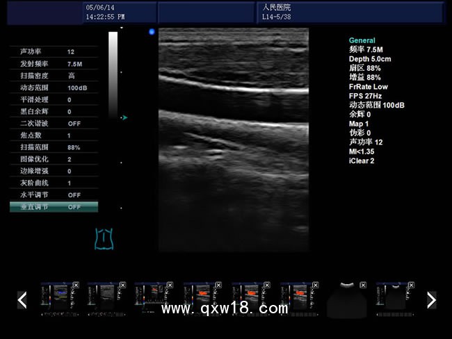 b超機 彩色b超機 心臟b超機 國產(chǎn)高端b超機 腹部乳腺b超