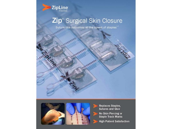 捷膚聯(lián)無創(chuàng)高強(qiáng)度皮膚縫合器