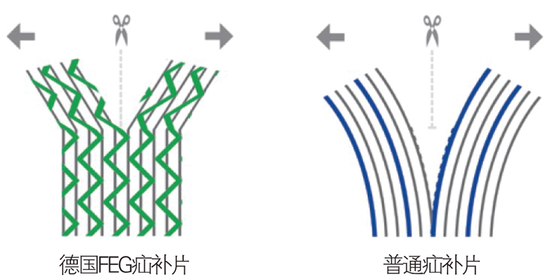 德國(guó)PVDF材質(zhì)疝氣補(bǔ)片-IPST
