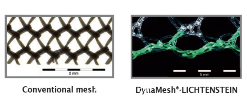 德國(guó)PVDF材質(zhì)疝氣補(bǔ)片-IPOM