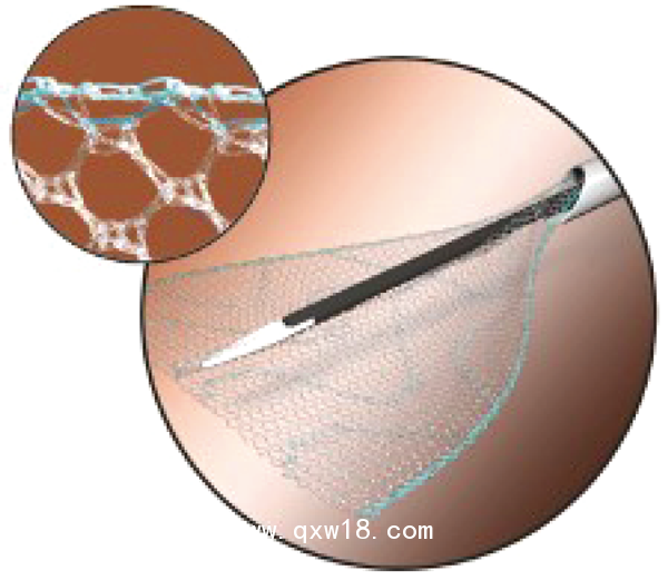 德國(guó)PVDF材質(zhì)疝氣補(bǔ)片-ENDOLAP
