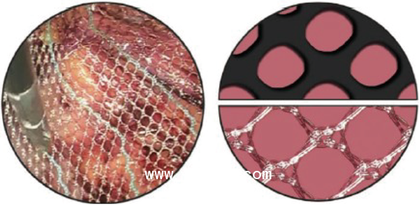 德國PVDF材質(zhì)疝氣補(bǔ)片-CICAT