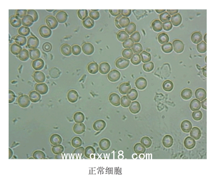 【惠斯安普】EIS紅細胞影像系統(tǒng)