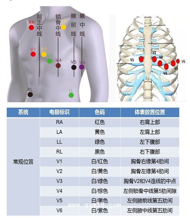 柯麗爾心臟監(jiān)護(hù)