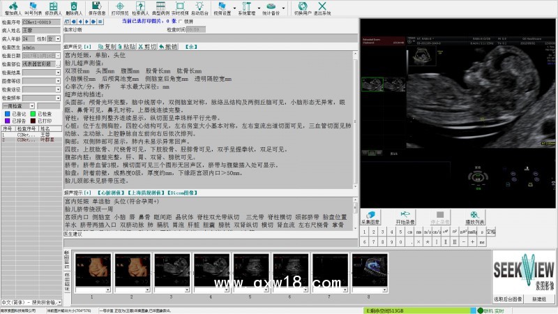 醫(yī)學影像工作站系統(tǒng)軟件