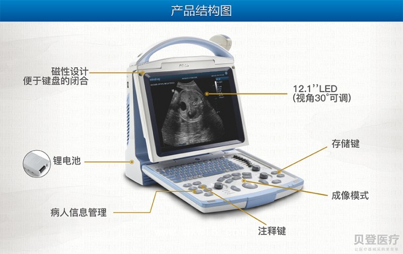 便攜式b超機(jī) DP10型全數(shù)字超聲診斷系統(tǒng)